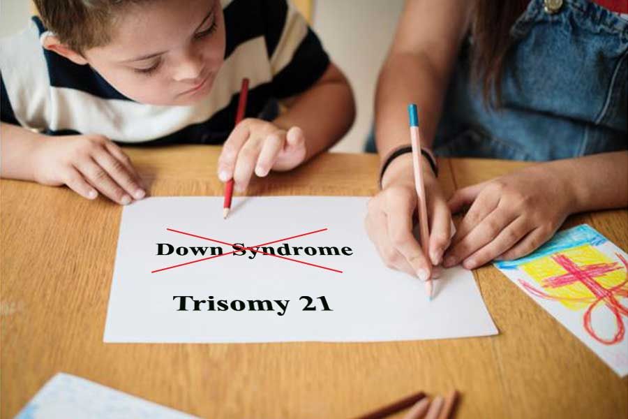 down syndrome trisomy 21 myths facts