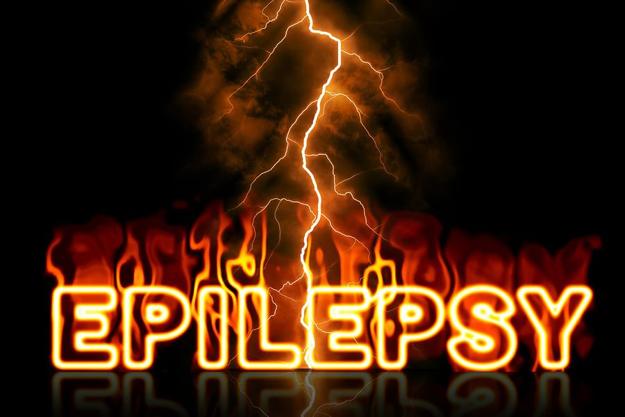 Health news epilepsy signs symptoms treatment
