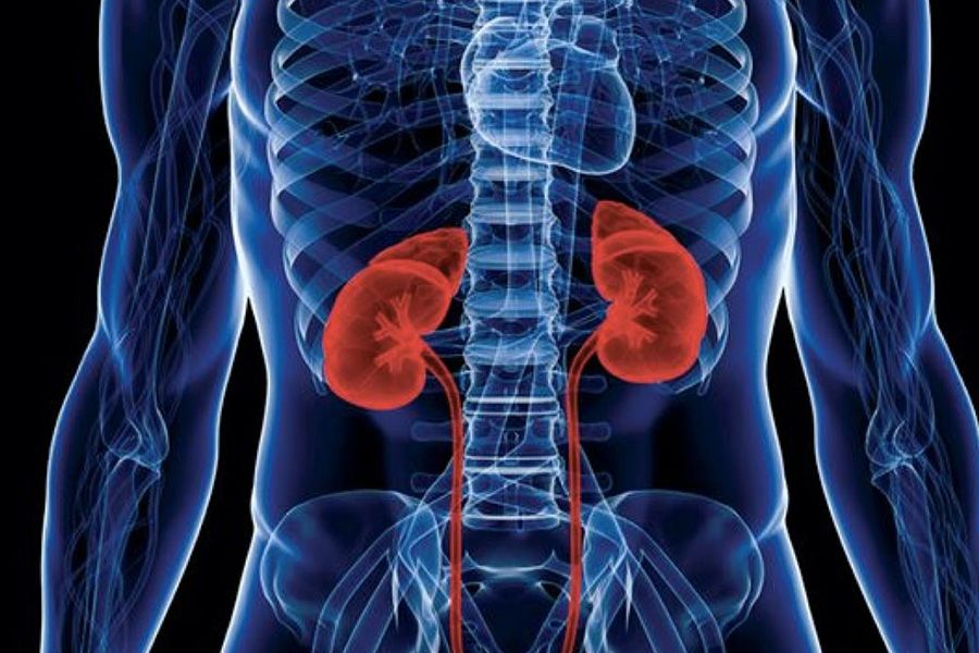 number of kidney patients in kerala on rise by Dr. Jayant Thomas Mathew