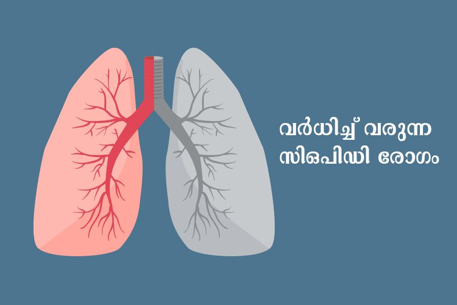 COPD 2nd Highest Killer Of Indians